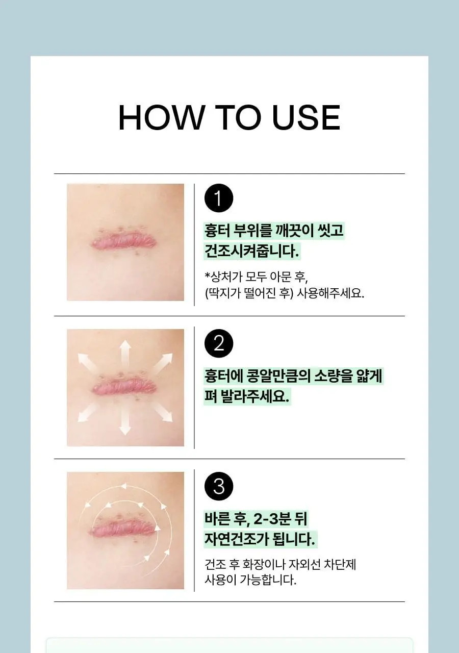 [흉터관리 의료기기] 셀라딕스 큐스카겔 10g 상세페이지 30